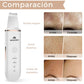 Miserwe: Limpiador Facial Ultrasónico 3 en 1