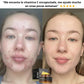 Dermacube®: Crema Antiacné con capsulas de Vitamina C