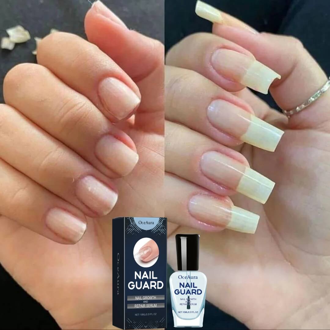 NailGuard®: Serum de Crecimiento y Reparación de Uñas