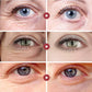Eelhoe: Tratamiento 21 días Retinol Antiedad