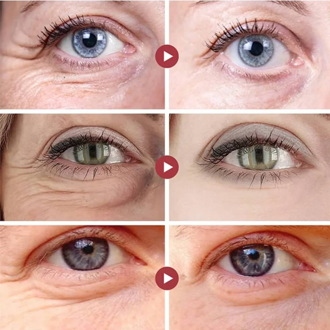 Eelhoe: Tratamiento 21 días Retinol Antiedad